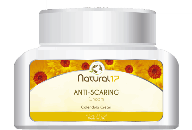calendula cream